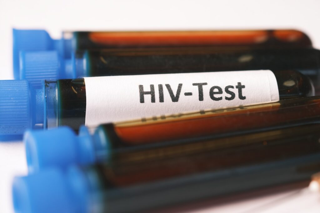 Which countries require HIV Testing for Visa?